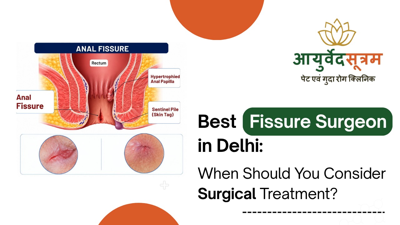 Best Fissure Doctor in Delhi